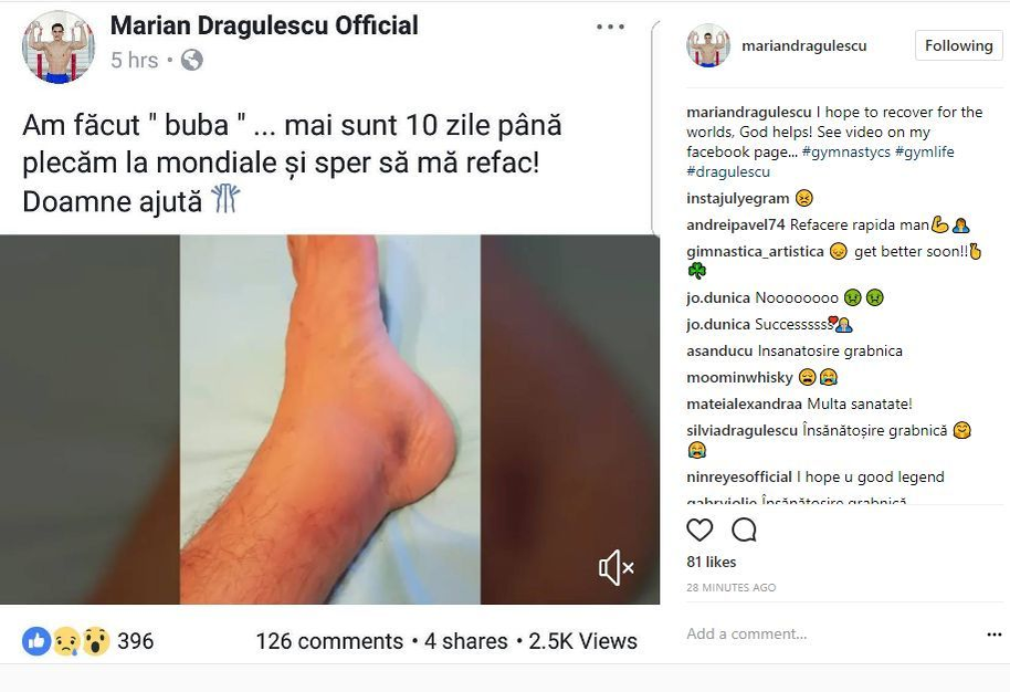 Marian Drăgulescu, accidentat chiar înainte de Mondiale!