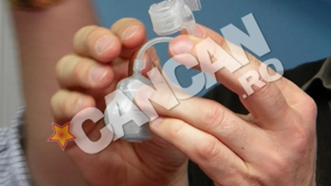 Aparat-minune folosit la Institutul de Transplant din Cluj! Mecanismul anti-pipi se baga in testicul si costa 3.000 de euro!