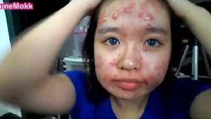 Transformare SOCANTA a unei fete care sufera de acnee! Cum reuseste sa scape de bubele inestetice de pe fata VIDEO