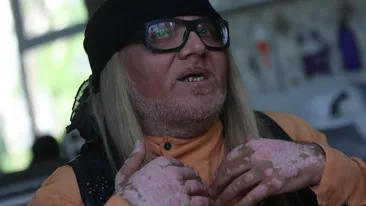 Vesti teribile pentru o vedeta de la noi bolnava de cancer! Are nevoie de 4.500 de euro si va face doua operatii pe creier!