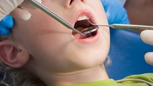12% dintre romani nu merg deloc la dentist