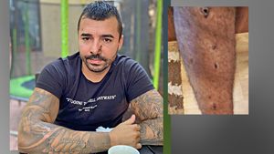 ”Mi-au dat cu toporul în cap, m-au tăiat, m-au împușcat!" Terorizat de membrii clanului Buricea, un brăilean își strigă disperarea în CANCAN.RO