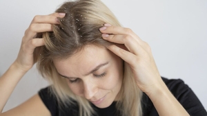 Când scalpul cere ajutor: dermatita seboreică și soluțiile naturale care pot calma pielea
