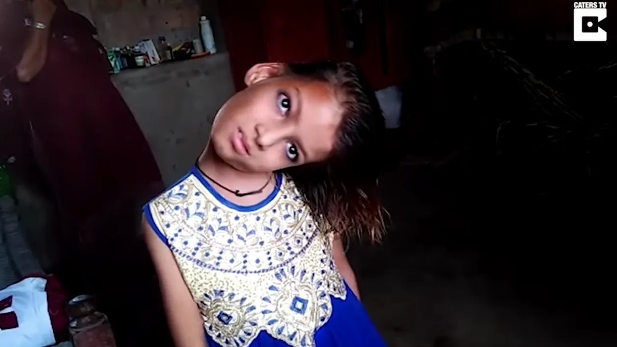 S-a nascut copil normal, insa acum are capul blocat la 180 de grade! Ce i s-a intamplat micutei la 8 luni de-a ajuns asa?