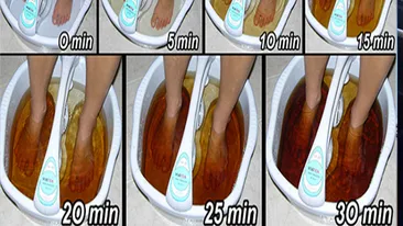 Uimitor! Cum îţi poţi detoxifia organismul prin tălpile picioarelor