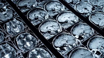 Gestul aparent inofensiv care îți poate dubla riscul de AVC. Majoritatea românilor îl fac fără să știe