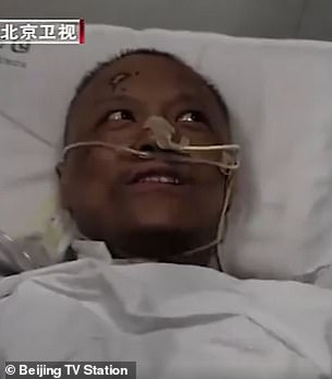 Doi medici infectați cu COVID-19 s-au trezit cu pielea neagră. Cum a fost acest lucru posibil. Foto incredibil