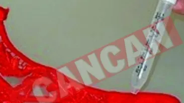 Un aparat descopera sperma de pe hainele partenerilor infideli