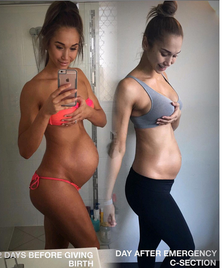 Fitness-modelul criticat pentru silueta impecabilă din timpul sarcinii a povestit prin ce chinuri a trecut: ”Muşchii mei blocau copilul înăuntru”