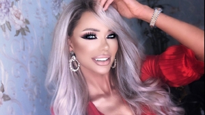 Bianca Drăgușanu, imagini șocante. Vedeta s-a afișat cu un cheag de sânge la ochi: „Am fost atacată de un dragon”