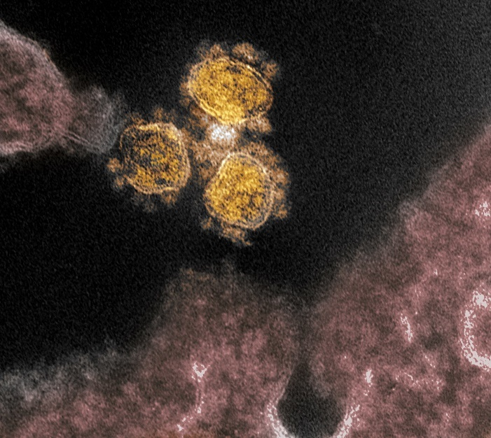 epa08252656 An undated handout picture made available by the National Institutes of Health (NIH) shows a transmission electron microscope image of SARS-CoV-2, the virus that causes COVID-19, isolated from a patient in the USA, with virus particles (round gold objects) seen emerging from the surface of cells cultured in the lab (issued 27 February 2020). The spikes on the outer edge of the virus particles give coronaviruses their name, crown-like. The novel coronavirus is on the verge of spreading across the world as more cases are emerging outside China with outbreaks in South Korea, Italy and Iran.  EPA/NIAID- RML/NATIONAL INSTITUTES OF HEALTH HANDOUT  HANDOUT EDITORIAL USE ONLY/NO SALES