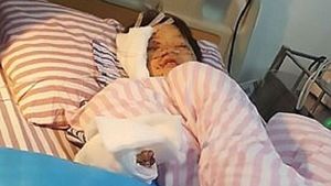 VIDEO / Un copil de 12 ani a fost mutilat după ce telefonul i-a explodat! Cum arată acum şi ce au găsit medicii pe trupul lui