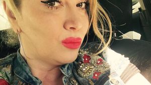 OANA LIS, la un pas de moarte! I s-a umflat capul şi s-a umplut de bube din cauza unui aliment pe care îl consumăm cu toţii