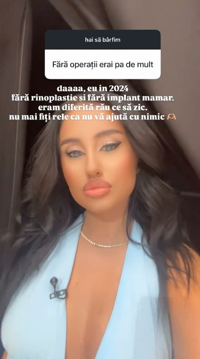 Rebecca Toma, adevărul despre intervențiile estetice. Ce modificări are la nivelul feței