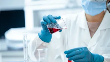 Virusul Marburg a făcut primele victime! Care sunt simptomele ce ar trebui să te îngrijoreze