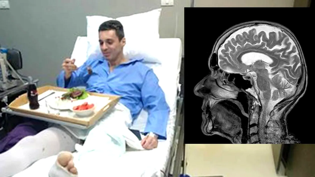 Mircea Badea, diagnostic șocant de la medici: Sunt în prag de atac cerebral din cauza loviturilor