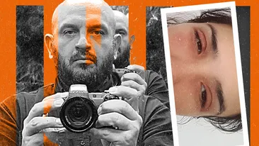 Fotomodel cunoscut, desfigurat după o prezentare de modă… Efectiv, i-a explodat fața!