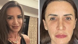 Mara Bănică, mesaj dur pentru cei care au criticat-o că și-a făcut lifting facial: ”Era mai bine să fi spus că m-am apucat de yoga?!”