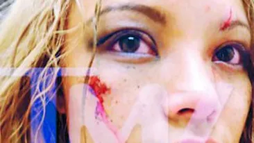 Lovita cu pietre si caca pe scena