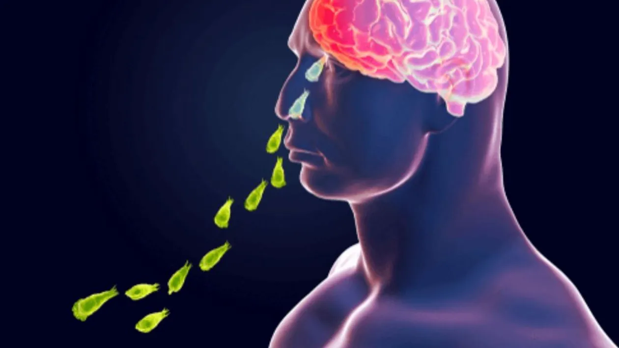 O fată de 10 ani, ucisă de parazitul mâncător de creier într-o săptămână