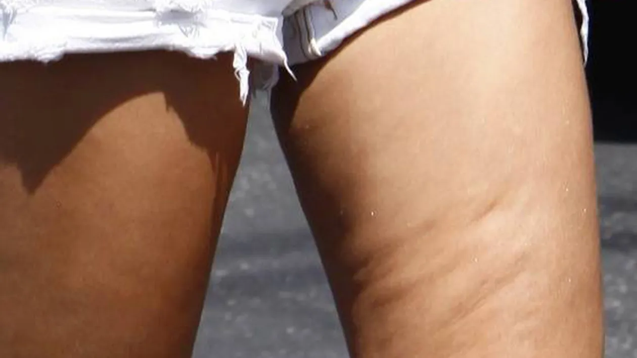 Cum sa arzi calorii rapid! Fructele care te ajuta sa scapi de celulita si de kilogramele in plus