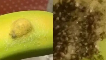 Dezgustător! Ce a descoperit o femeie sub coaja unei banane: ”Am simțit mâncărimi peste tot”