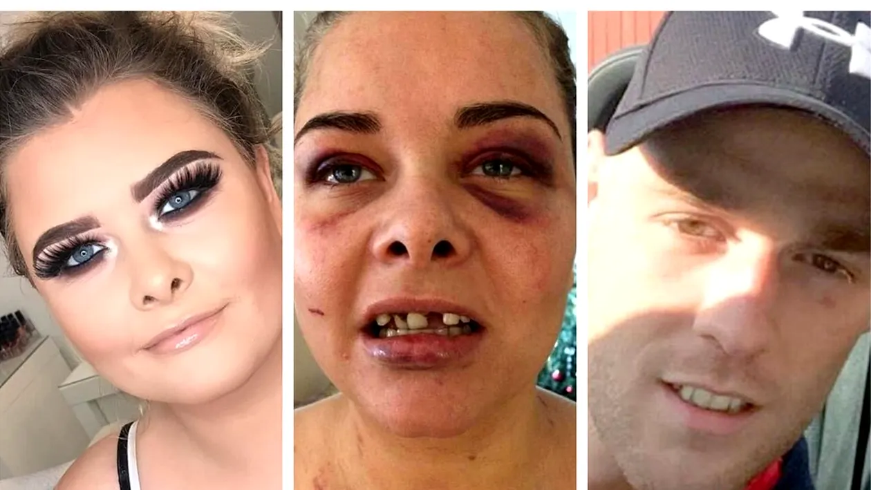 Un bărbat și-a bătut iubita și i-a spart trei dinți din cauză că a schimbat poza de pe Facebook și el nu mai apărea în ea