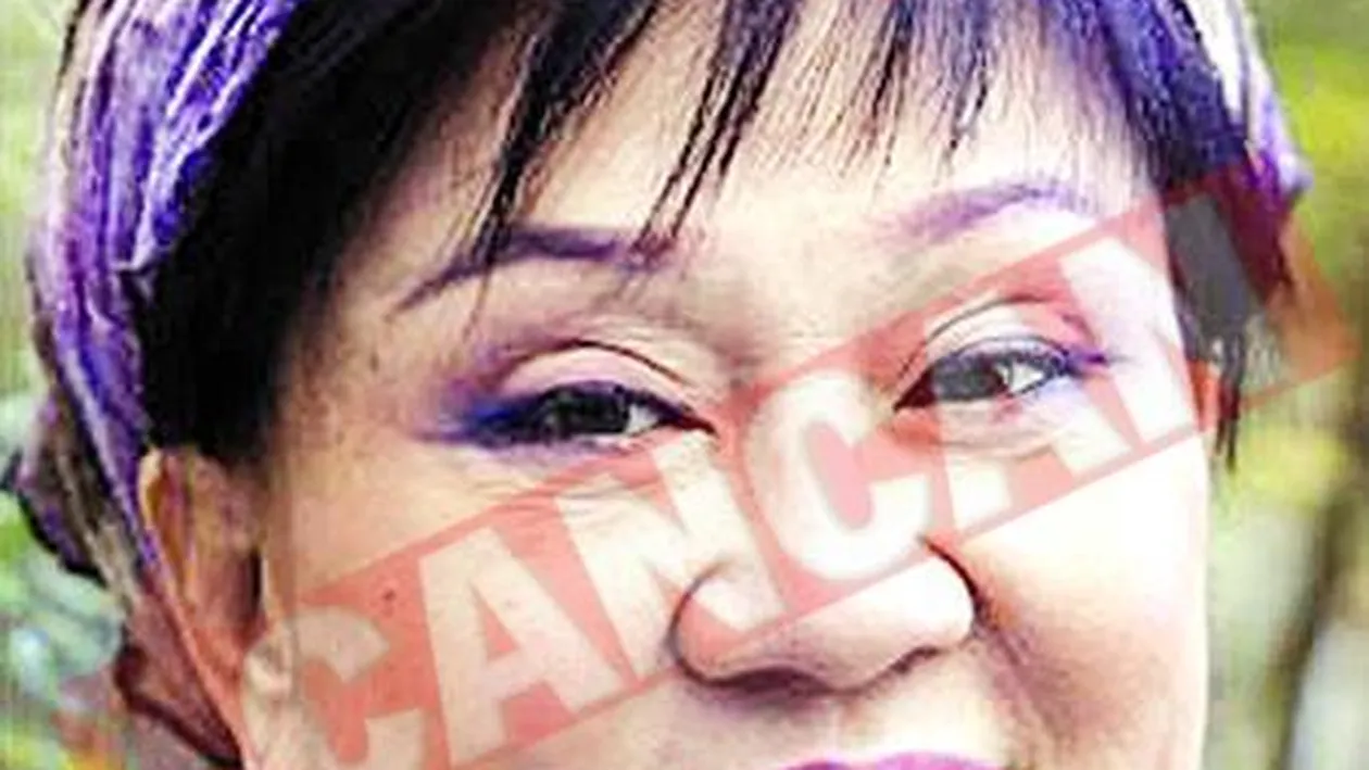 A facut peste 50 de operatii estetice