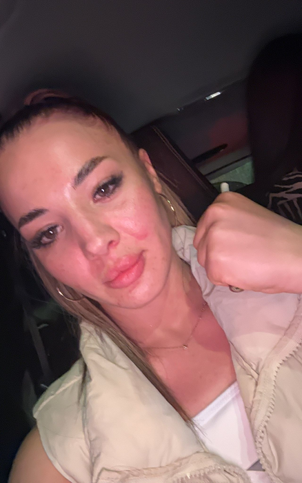 Roxana Țuțu spune că se va mai resimți după luptă câteva zile
