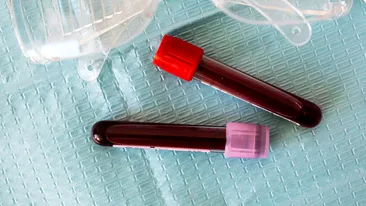 Cercetătorii au descoperit care este grupa de sânge cea mai afectată de COVID