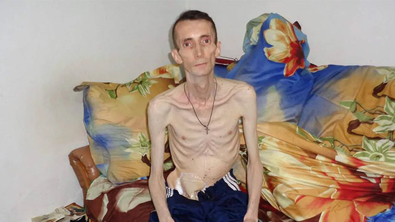 La 47 de ani, Eugen Movilă are doar 28 kg! “Nu am mai mâncat nimic de 3 ani”