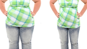 Solutia chirurgicala pentru grasimea nedorita de pe fese, abdomen, genunchi, solduri si talie! Tot ce trebuie sa stii despre liposuctie