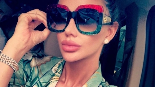 Bianca Drăguşanu şi-a mărit din nou buzele! Cum arată blonda după noua intervenţie estetică