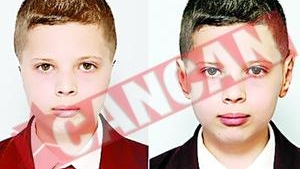 S-a nascut fara urechi