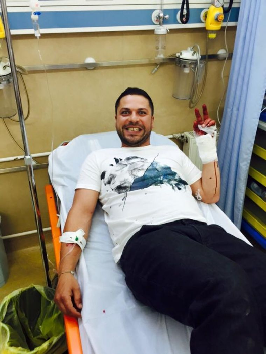 Augustin Viziru și-a tăiat mâna cu un topor la ”Ferma Vedetelor” de la Pro TV