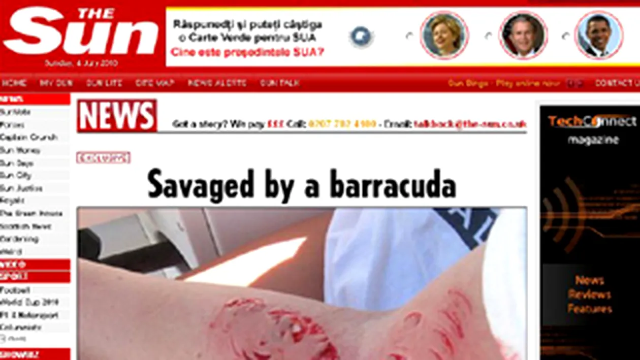 O stiuca de mare aproape ca i-a sfartecat bratul unei adolescente!