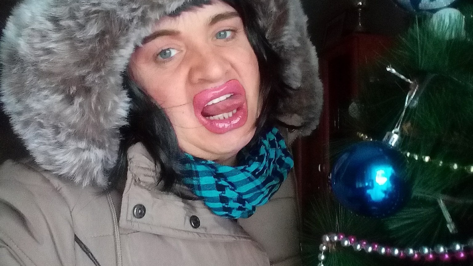 Cristi din Banat, ”torturat” de medicul estetician. ”Doar supă pot suge...”