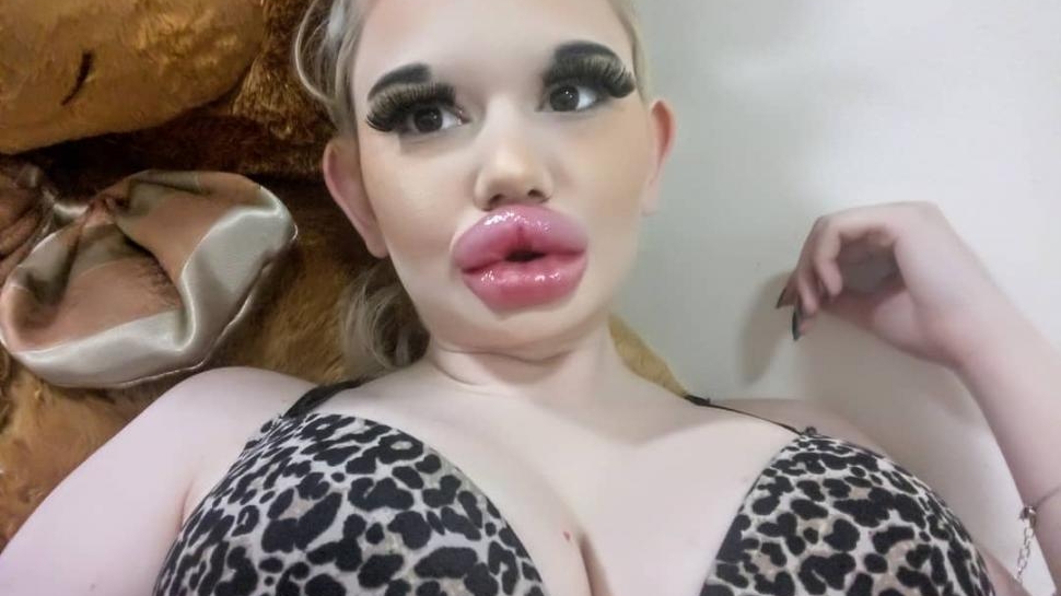 Femeia cu cele mai mari buze din lume s-a operat din nou! Cum arată acum Andrea Ivanova. „Nu există limite”