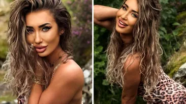 Cum arată Maria Avram de la Insula Iubirii la 11 zile de la operația estetică suferită. Ce schimbare majoră!