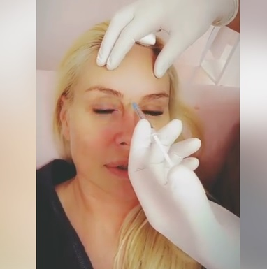 Vica Blochina, sacrificii pentru un ten fără riduri