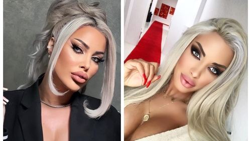 Loredana Chivu, operată de urgență! Ce s-a întâmplat cu fosta asistentă Tv