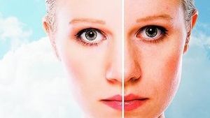 Cum afecteaza ultravioletele epiderma. Ridurile si soarele