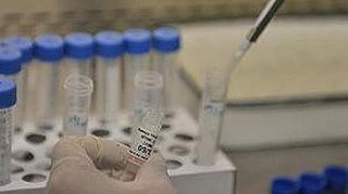 Atentie! Medicii nu recomanda testele rapide de depistare a gripei