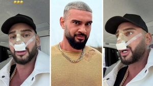 Dorian Popa, la un pas să îi „cadă nasul ca lui Michael Jackson”! Ce i-a descoperit medicul la operație? „Habar nu aveam”