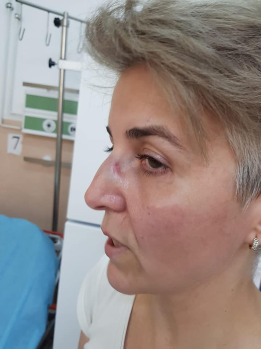 Scene halucinante. O asistentă de la ATI, bătută de o colegă de spital din gelozie