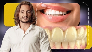 Cum își pot albi românii dinții în mod natural? Ce spune Dr. Cezar despre smalț, dentină și rolul unei vitamine importante