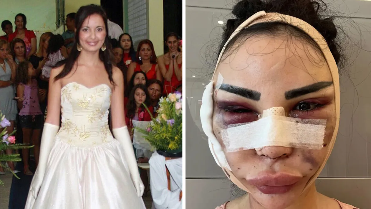 Tânăra din imagine a făcut 40 de operații estetice, de 600.000 de euro, pentru a arăta precum Kim Kardashian. Dar regretă enorm. Cum arată, de fapt