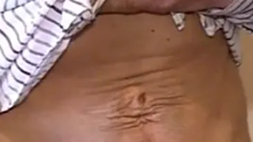 Mutilata pe viata! Afla prin ce drama a trecut o tanara din Craiova!