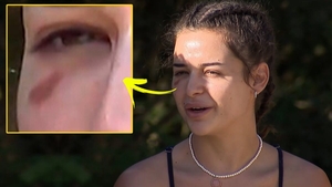 Oana Ciocan, cu o lovitură suspectă la Survivor All Stars. Ce a pățit iubita lui Jador, de fapt