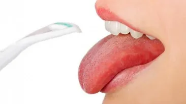 Un nou simptom asociat infecție cu virusul SARS-CoV-2! Ce este „limba Covid” și cum se manifestă